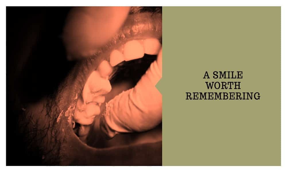 otto warmbier teeth before and after