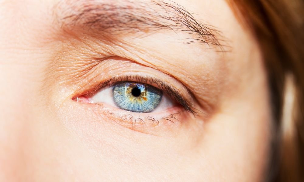 Double Eyelid
